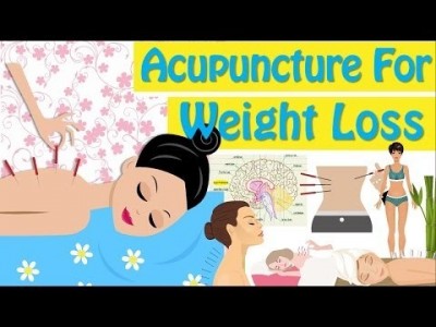 Acupuncture For Weight Loss How Does Acupuncture Work